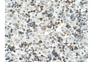 HSD17B6 antibody was used for immunohistochemistry at a concentration of 4-8 ug/ml to stain Hemopoietic cells (arrows) in Human Liver.