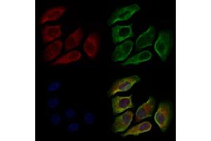 ABIN6264835 and ABIN6279045 staining Hela cells by IF/ICC.