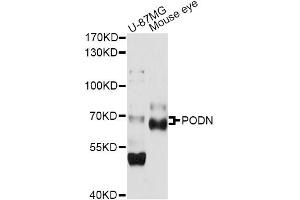 Western blot analysis of extracts of various cell lines, using PODN antibody (ABIN6290800) at 1:1000 dilution. (Podocan anticorps)