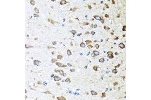 Immunohistochemistry of paraffin-embedded mouse brain using ACVR1C antibody at dilution of 1:100 (40x lens). (ACVR1C/ALK7 anticorps)