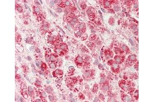 Formalin-fixed and paraffin-embedded H.