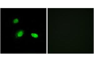 Immunofluorescence analysis of A549 cells, using HSPB2 Antibody. (HSPB2 anticorps  (AA 121-170))