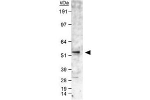 Western blot analysis of CYP19A1 in human fetal temporal lobe lysate using CYP19A1 polyclonal antibody . (Aromatase anticorps  (AA 400-502))