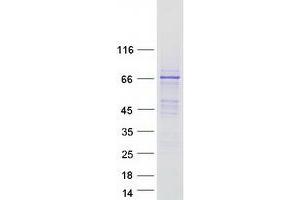 Validation with Western Blot