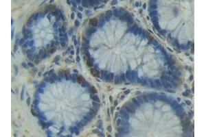 Detection of ITGaD in Human Rectum Tissue using Polyclonal Antibody to Integrin Alpha D (ITGaD)