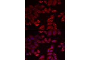 Immunofluorescence analysis of HeLa cell using SEPHS1 antibody.