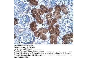Rabbit Anti-DDC Antibody  Paraffin Embedded Tissue: Human Kidney Cellular Data: Epithelial cells of renal tubule Antibody Concentration: 4. (DDC anticorps  (N-Term))