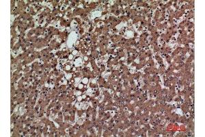 Immunohistochemistry (IHC) analysis of paraffin-embedded Human Liver, antibody was diluted at 1:100.