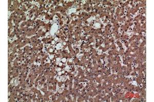 Immunohistochemistry (IHC) analysis of paraffin-embedded Human Liver, antibody was diluted at 1:100. (PSG1 anticorps  (Internal Region))