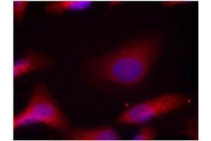 Image no. 3 for anti-Nuclear Receptor Coactivator 1 (NCOA1) (pTyr529) antibody (ABIN196876)