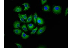 Immunofluorescence staining of A549 cells with ABIN7146237 at 1:133, counter-stained with DAPI.