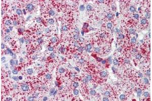 Human Liver (formalin-fixed, paraffin-embedded) stained with SP4 antibody ABIN462207 followed by biotinylated goat anti-rabbit IgG secondary antibody ABIN481713, alkaline phosphatase-streptavidin and chromogen.