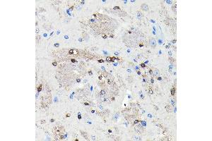 Immunohistochemistry of paraffin-embedded mouse brain using NMDA Rabbit mAb (ABIN7267420) at dilution of 1:100 (40x lens). (NMDAR2A anticorps)