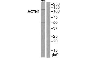 Western blot analysis of extracts from K562 cells, using ACTN1 antibody.