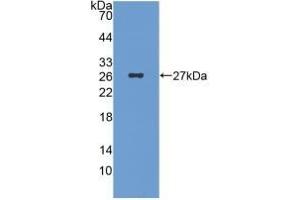 Detection of Recombinant ICA1, Human using Monoclonal Antibody to Islet Cell Autoantigen 1 (ICA1) (ICA1 anticorps  (AA 1-258))