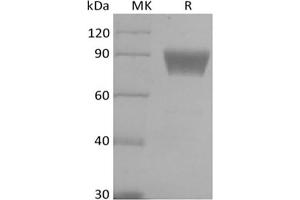 Western Blotting (WB) image for V-Set Domain Containing T Cell Activation Inhibitor 1 (VTCN1) (Active) protein (Biotin) (ABIN7319876)