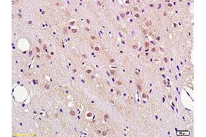 Formalin-fixed and paraffin embedded rat brain tissue labeled with Anti FBXW7/CDC4 Polyclonal Antibody, Unconjugated (ABIN1386103) at 1:200 followed by conjugation to the secondary antibody and DAB staining. (FBXW7 anticorps  (AA 501-600))