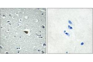 Immunohistochemistry analysis of paraffin-embedded human brain tissue, using BAI1 Antibody. (BAI1 anticorps  (AA 691-740))