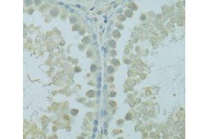 Immunohistochemistry of paraffin-embedded Rat testis using HUS1B Polyclonal Antibody at dilution of 1:100 (40x lens).