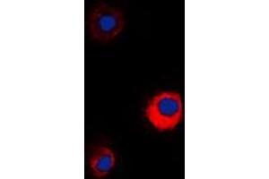Immunofluorescent analysis of MUC13 staining in KNRK cells.