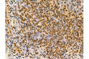 ABIN6257344 and ABIN6274221 at 1/100 staining Rat ovarian tissue by IHC-P. (MZF1 anticorps  (N-Term))