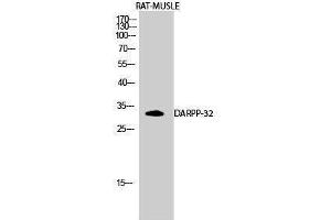 Western Blotting (WB) image for anti-Protein Phosphatase 1, Regulatory (Inhibitor) Subunit 1B (PPP1R1B) (Tyr785) antibody (ABIN3180011) (DARPP32 anticorps  (Tyr785))