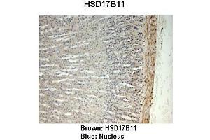 Sample Type :  Monkey adrenal gland   Primary Antibody Dilution :   1:25   Secondary Antibody:  Anti-rabbit-HRP   Secondary Antibody Dilution:   1:1000   Color/Signal Descriptions:  Brown: HSD17B11 Blue: Nucleus   Gene Name:  HSD17B11   Submitted by:  Jonathan Bertin, Endoceutics Inc.