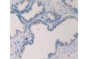 Detection of TPS in Human Prostate Gland Tissue using Monoclonal Antibody to Tryptase (TPS)