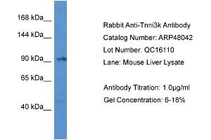 Western Blotting (WB) image for anti-TNNI3 Interacting Kinase (TNNI3K) (Middle Region) antibody (ABIN2783203) (TNNI3K anticorps  (Middle Region))