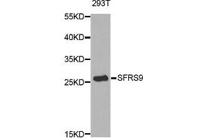 Western blot analysis of extracts of 293T cell line, using SFRS9 antibody. (SFRS9 anticorps)