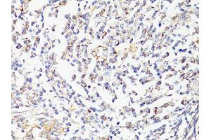 Immunohistochemistry of paraffin-embedded human tonsil using MTOR antibody (ABIN6292920) at dilution of 1:150 (40x lens).
