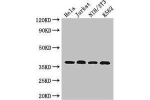 Western Blot Positive WB detected in: Hela whole cell lysate, Jurkat whole cell lysate, NIH/3T3 whole cell lysate, K562 whole cell lysate All lanes: RAD51 antibody at 2.