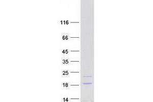 Validation with Western Blot