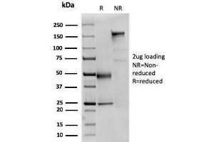 SDS-PAGE Analysis Purified Fodrin Mouse Monoclonal Antibody (SPTAN1/3351). (SPTAN1 anticorps  (AA 2351-2475))