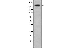 Western blot analysis SPTBN1 using HeLa whole cell lysates (SPTBN1 anticorps  (N-Term))