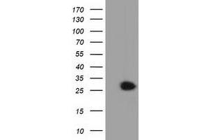 Western Blotting (WB) image for anti-Glutathione S-Transferase theta 2 (GSTT2) antibody (ABIN1498559) (GSTT2 anticorps)