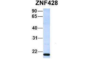 Host:  Rabbit  Target Name:  ZNF428  Sample Type:  293T  Antibody Dilution:  1. (ZNF428 anticorps  (Middle Region))