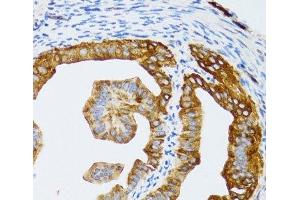 Immunohistochemistry of paraffin-embedded Rat fallopian tube using CHAF1B Polyclonal Antibody at dilution of 1:100 (40x lens). (CHAF1B anticorps)