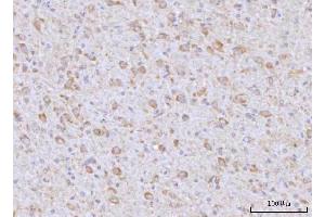 IHC analysis of RAP1GAP using anti-RAP1GAP antibody (ABIN7599729). (RAP1GAP anticorps  (AA 11-661))