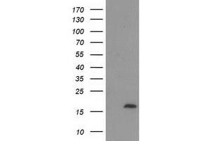 Western Blotting (WB) image for anti-Chromosome 2 Open Reading Frame 40 (C2orf40) antibody (ABIN1497048) (C2orf40 anticorps)