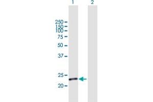 Western Blot analysis of C19orf80 expression in transfected 293T cell line by C19orf80 MaxPab polyclonal antibody. (C19ORF80 anticorps  (AA 1-251))