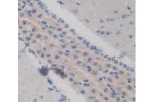 Used in DAB staining on fromalin fixed paraffin- embedded Kidney tissue (KERA anticorps  (AA 21-292))