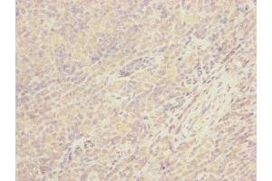 Immunohistochemistry of paraffin-embedded human tonsil tissue using ABIN7147374 at dilution of 1:100 (CEP57L1 anticorps  (AA 1-167))