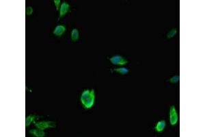 Immunofluorescent analysis of Hela cells using ABIN7158724 at dilution of 1:100 and Alexa Fluor 488-congugated AffiniPure Goat Anti-Rabbit IgG(H+L)