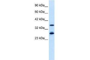 WB Suggested Anti-M96 Antibody Titration:  0. (MTF2 anticorps  (Middle Region))