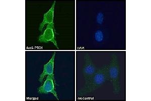 ABIN185521 Immunofluorescence analysis of paraformaldehyde fixed NIH3T3 cells, permeabilized with 0.