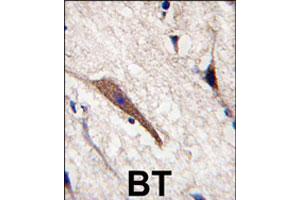 Formalin-fixed and paraffin-embedded human brain tissue reacted with PAK7 polyclonal antibody  , which was peroxidase-conjugated to the secondary antibody, followed by DAB staining. (PAK7 anticorps  (AA 183-198))
