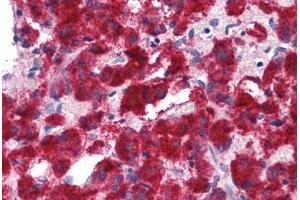 Human Adrenal: Formalin-Fixed, Paraffin-Embedded (FFPE)