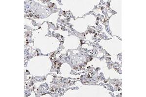 Immunohistochemical staining of human lung with ZNF77 polyclonal antibody  shows strong cytoplasmic positivity in subsets of alveolar cells. (ZNF77 anticorps)