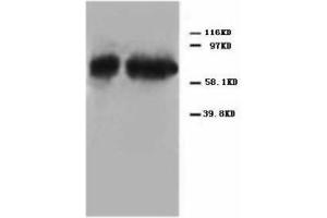 Image no. 2 for anti-Tumor Protein P73 (TP73) (C-Term) antibody (ABIN1492940) (Tumor Protein p73 anticorps  (C-Term))